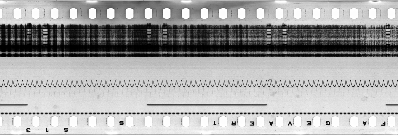 FR751142302_IDN_S_0395_1976_0010 PNG