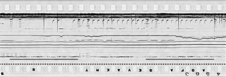 FR751142302_IDN_S_0399_1976_0039 PNG