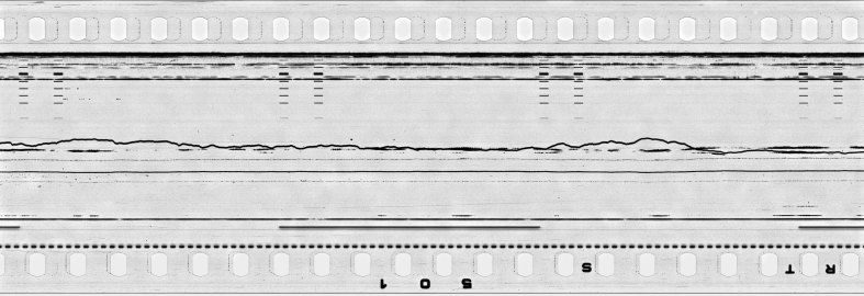 FR751142302_IDN_S_0399_1976_0171 PNG