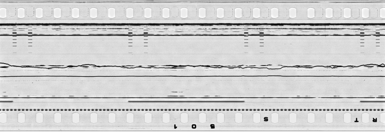 FR751142302_IDN_S_0399_1976_0174 PNG