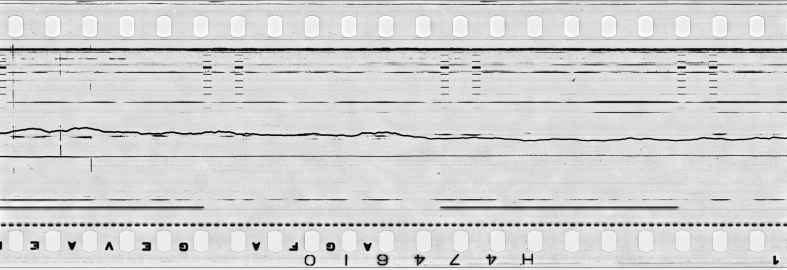 FR751142302_IDN_S_0399_1976_0181 PNG