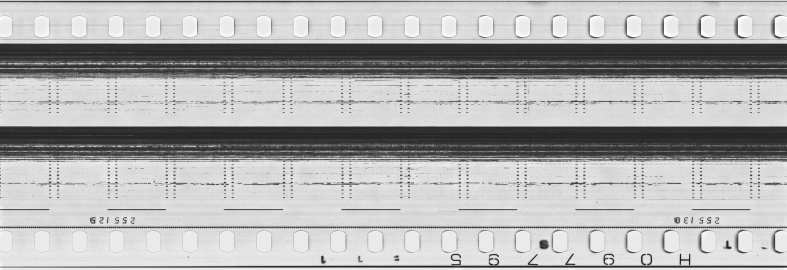 FR751142302_RDN_S_0381_1981_0020 PNG